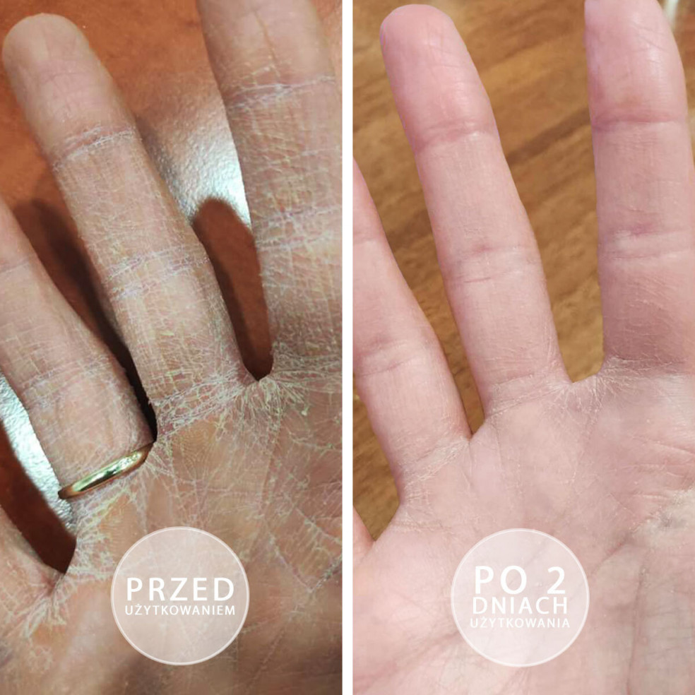 S.O.S - Intensely moisturizing... S.O.S - Intensely moisturizing...