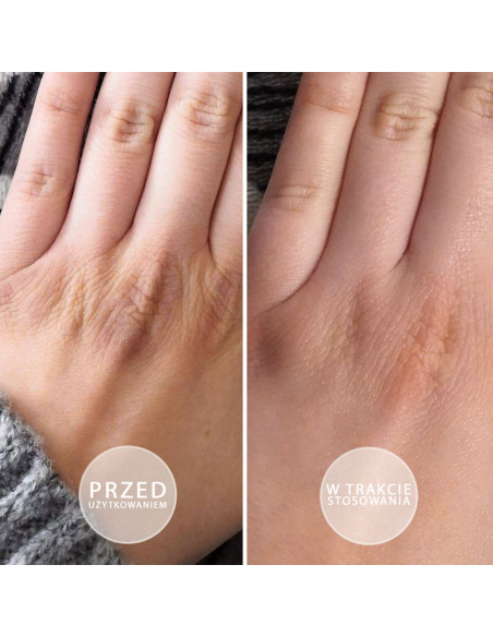 S.O.S. - Intensywnie natłuszczająca maść z witaminą E 5 x 15ml