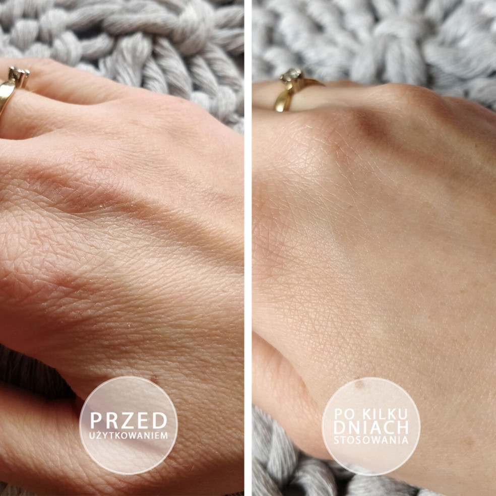 S.O.S - Intensely moisturizing... S.O.S - Intensely moisturizing...