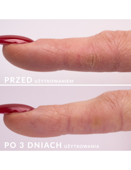 S.O.S - Regenerating serum for skin and nails 10ml