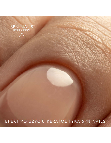 SPN Nails Keratolytic - cuticle softener 30ml