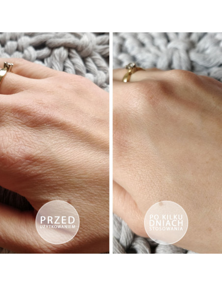 Pakiet 50 maści S.O.S. z witaminą E 100ml