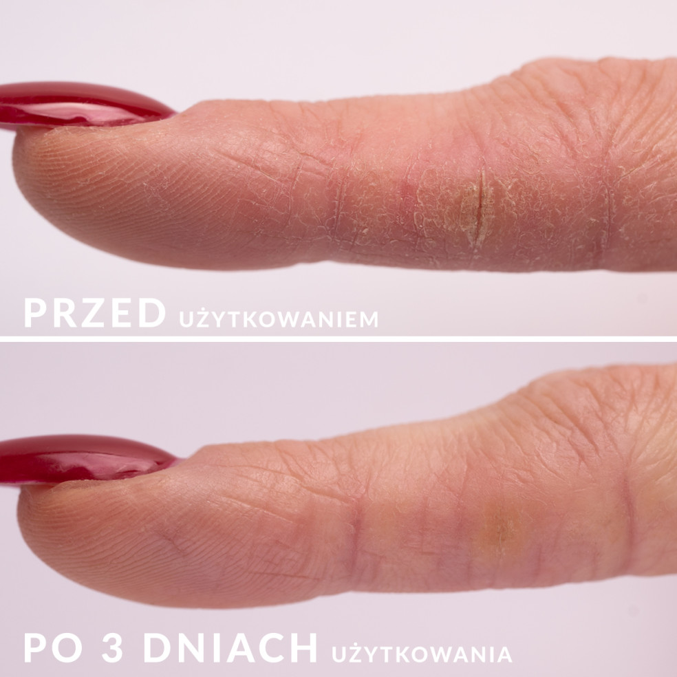 20 x S.O.S - Regenerating serum for... 20 x S.O.S - Regenerating serum for...