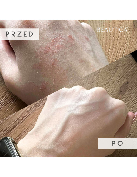 S.O.S. - Regenerujące serum do skóry i paznokci 10ml