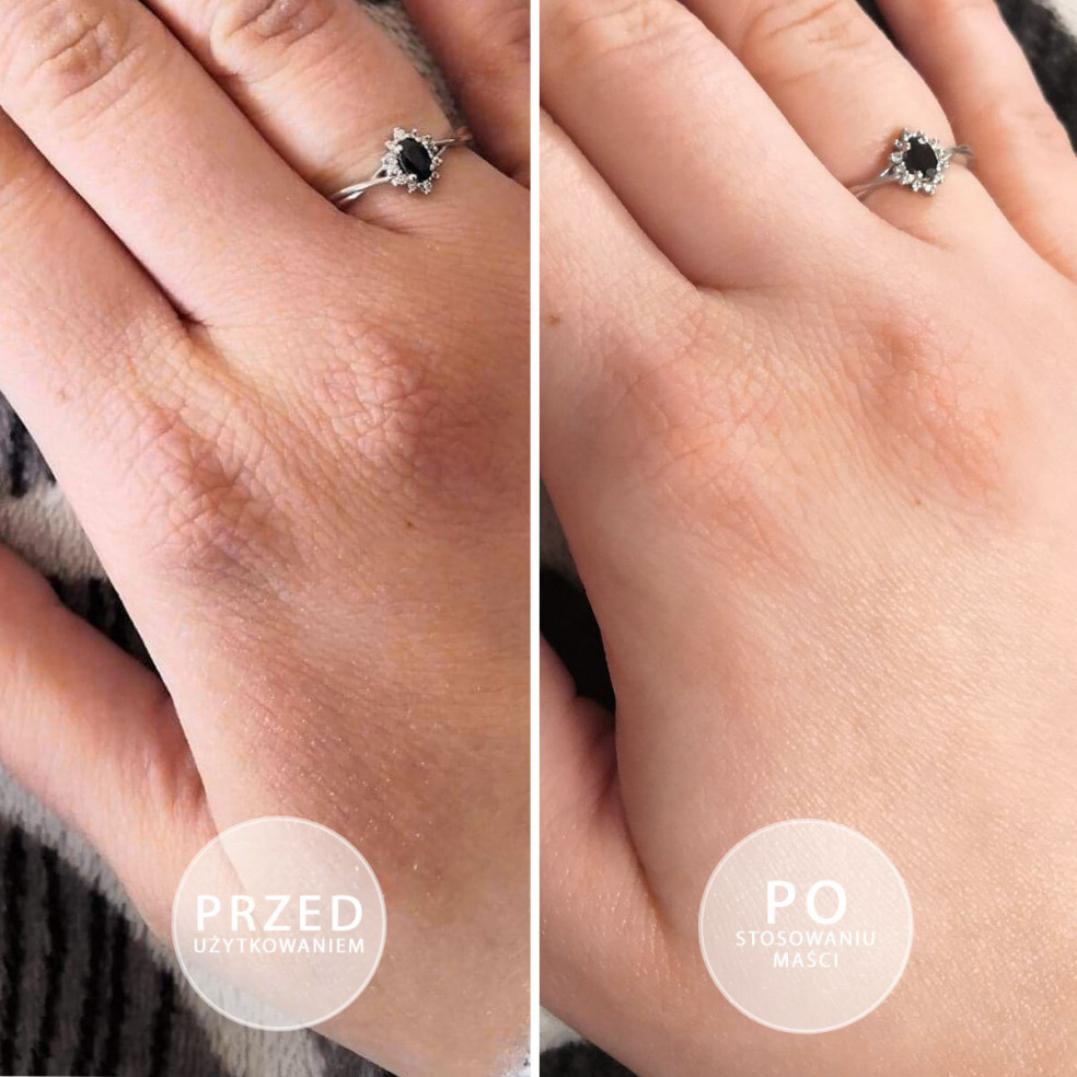 60 x S.O.S - Intensely moisturizing... 60 x S.O.S - Intensely moisturizing...