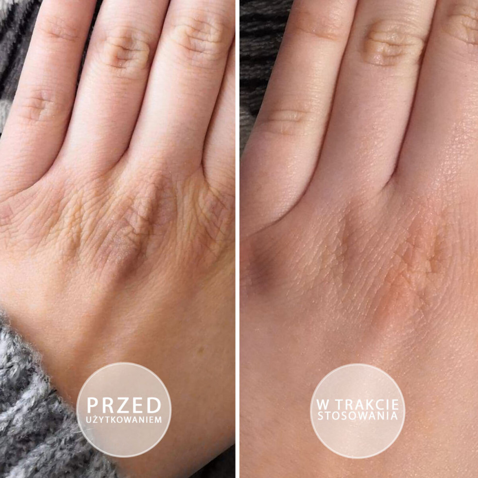 Pakiet 60 maści S.O.S. z witaminą E 15ml