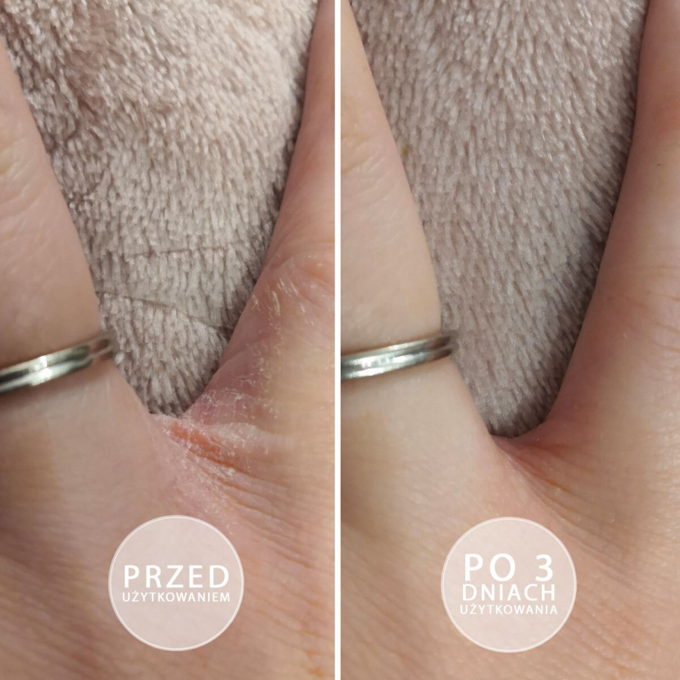 Sample S.O.S Intensely moisturizing...