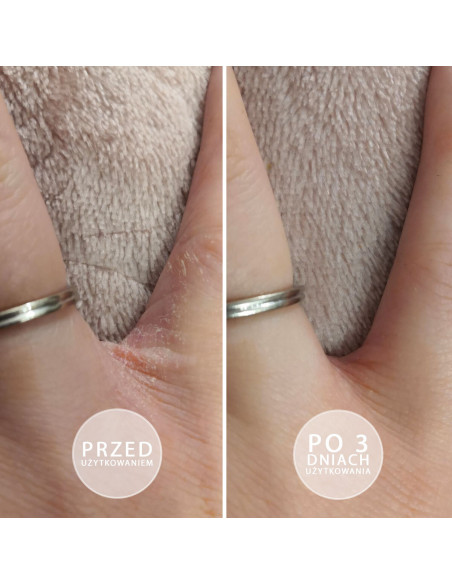 Sample S.O.S Intensely moisturizing ointment with vitamin E 3g