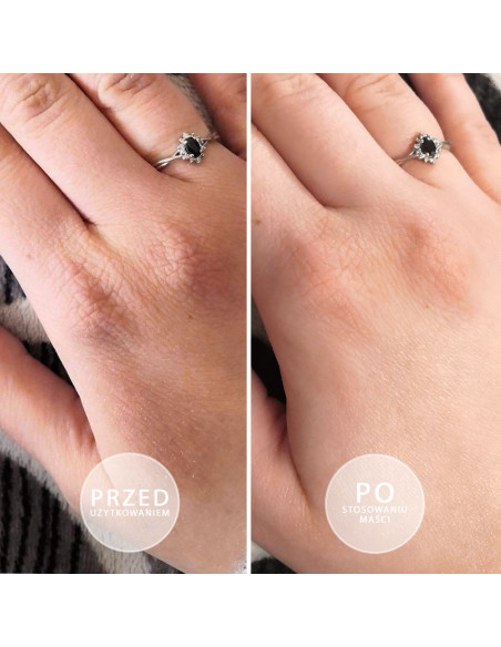 Sample S.O.S Intensely moisturizing ointment 3g
