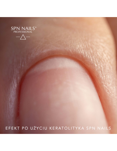 copy of SPN Nails Keratolytic - cuticle softener 30ml