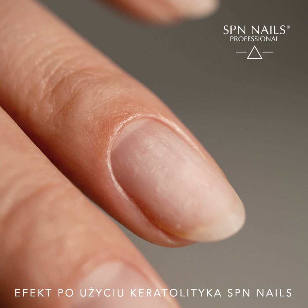 Płytka paznokcia przygotowana pod manicure hybrydowy. Skórki usunięte bez frezarki za pomocą płyny zmiękczającego keratolityk