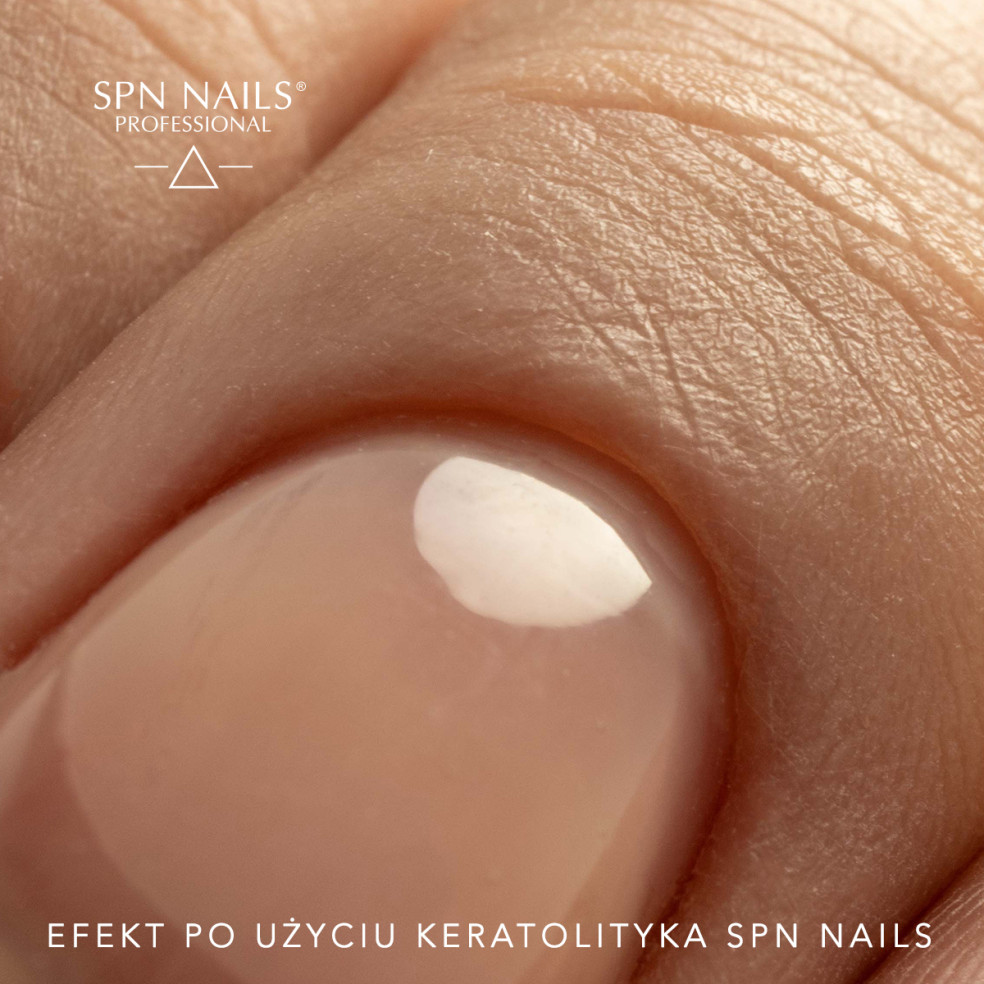 copy of SPN Nails Keratolytic -...