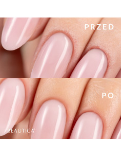 S.O.S. Dry Oil - Suchy... 2