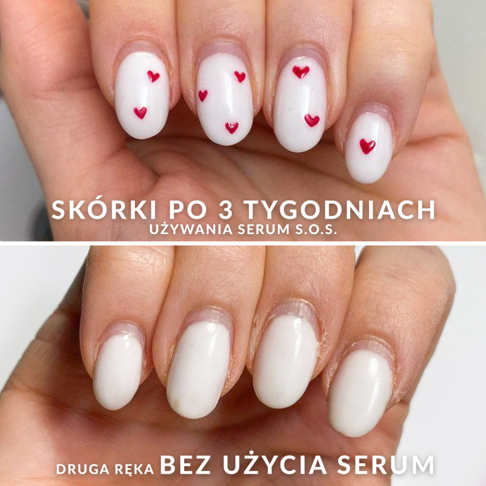 S.O.S. - Regenerujące serum do skóry...