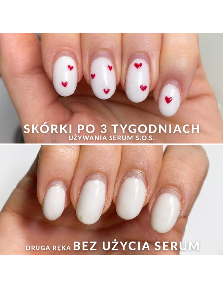 S.O.S. - Regenerujące serum do skóry i paznokci 10ml - Termin ważności 05.2026