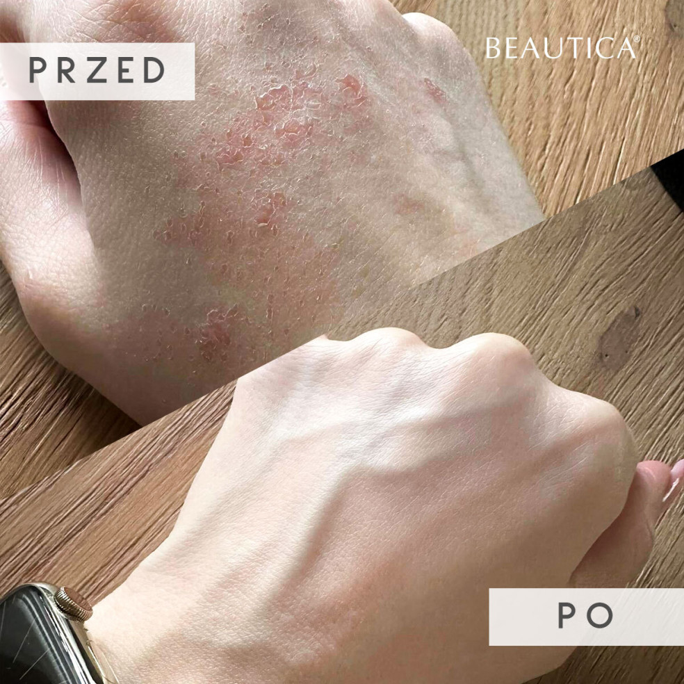 S.O.S - Regenerating serum for skin...